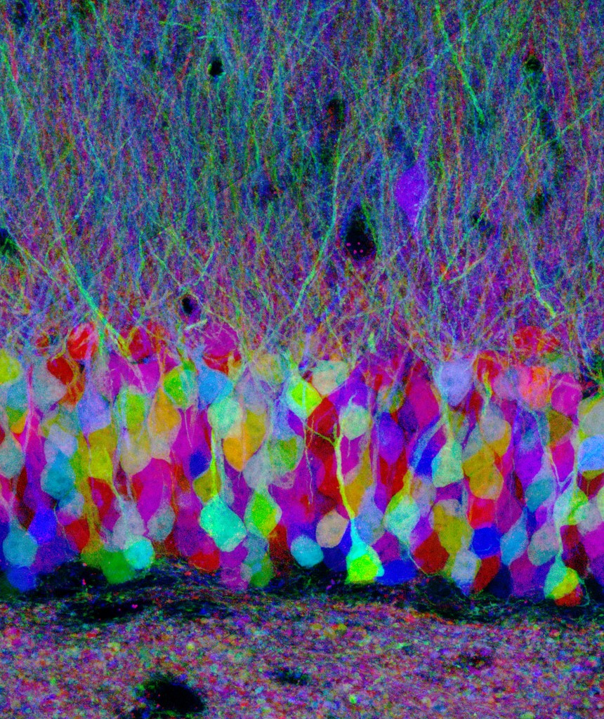 Neurons mapped using a different colored fluorescent protein